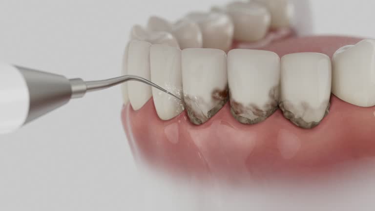 Reliable Teeth Cleaning And Checkup contractor in Smith County County, MS by Dentist Open Now